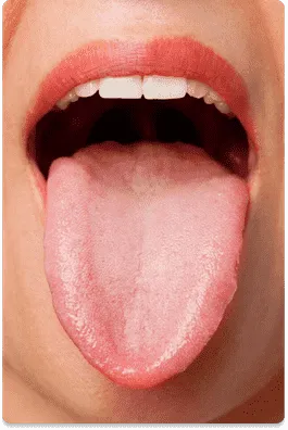 Tongue Cancer- Dr.Amit Chakraborty