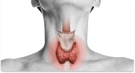 Total Thyroidectomy- Purpose of Thyroid Surgery- Dr.Amit Chakraborty