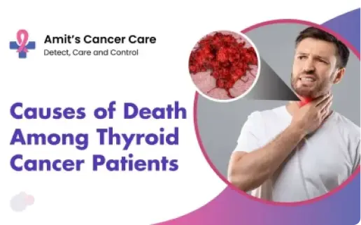 Causes of death among thyroid cancer patients- Dr.Amit Cancer Care