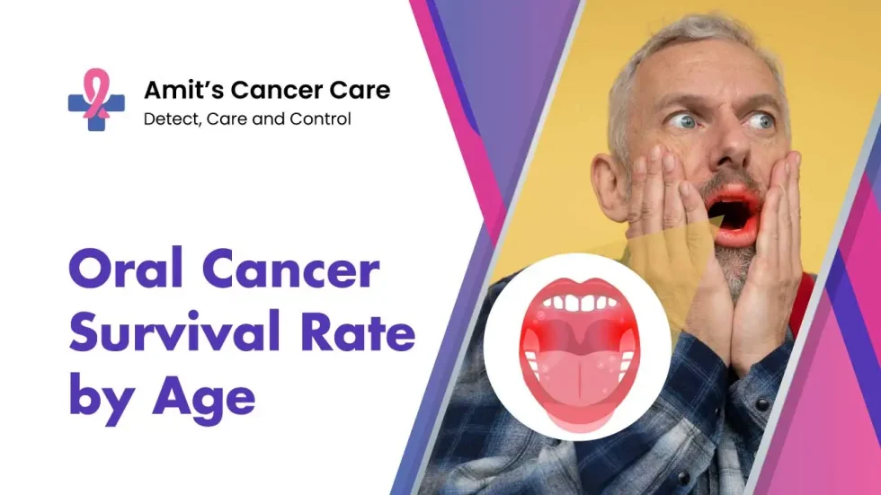 Oral Cancer Survival Rate by age- Dr.Amit Cancer Care