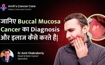 Buccal Mucosa Cancer: Diagnosis & Treatment