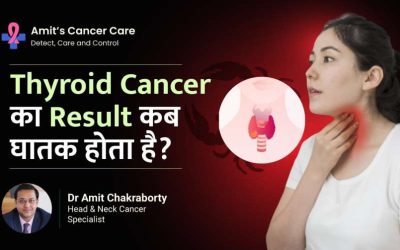 Dangerous result of thyroid cancer- Dr.Amit Cancer Care