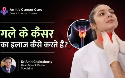 Solution of neck cancer video- Dr.Amit Cancer Care