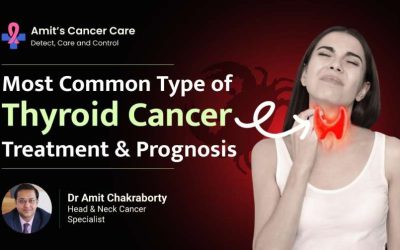 Thyroid Cancer Treatment and Prognosis