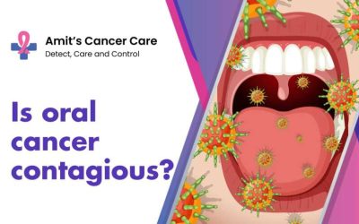 Oral cancer contagious- Dr.Amit Cancer Care