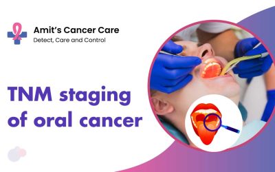 TNM staging of oral cancer: dr. amit cancer care