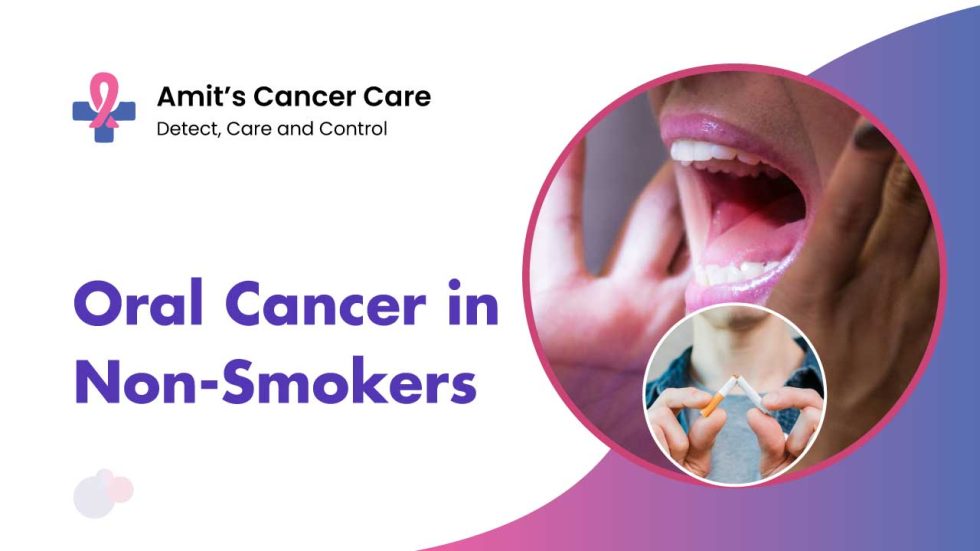 Causes of Mouth Cancer in a Non-Smoker