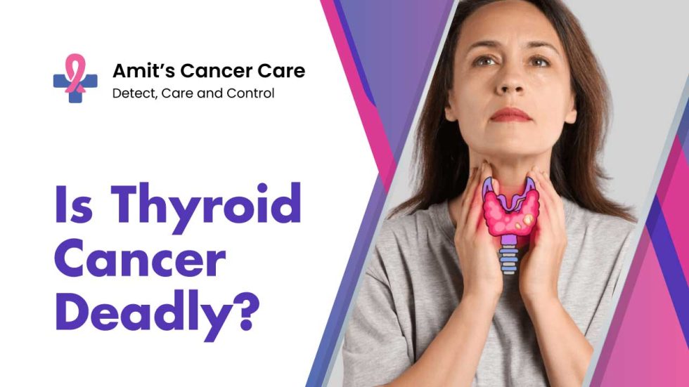 Thyroid Cancer deadly
