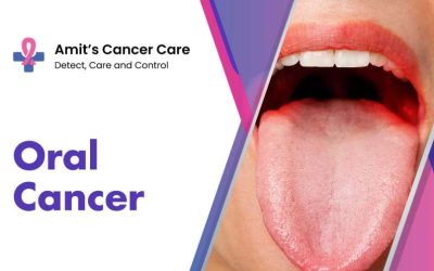 Oral Cancer Treatment Cost in Mumbai