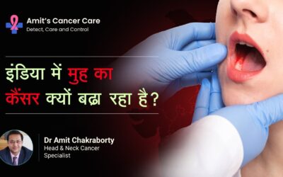 Why Oral Cancer Is Increasing in India?