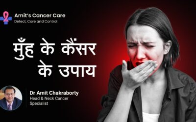 Treatment for Mouth cancer: Dr. Amit Cancer Care