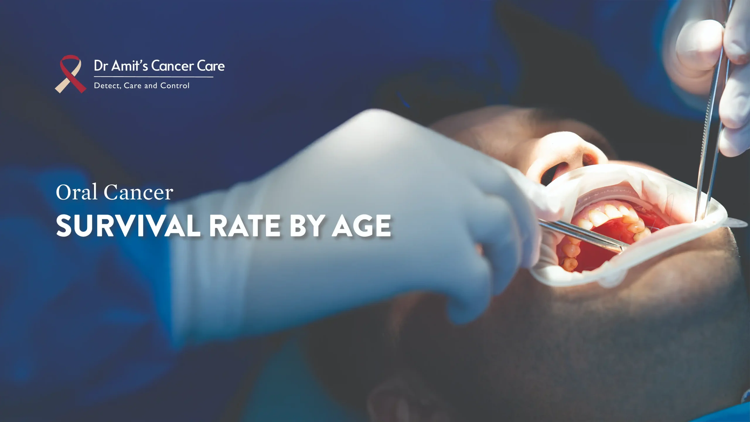 Oral Cancer Survival Rate by Age