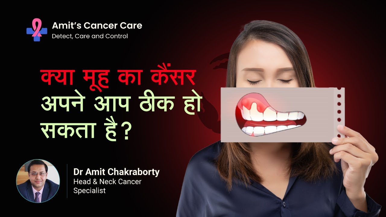 Can Mouth Cancer Get Cured on Its Own?