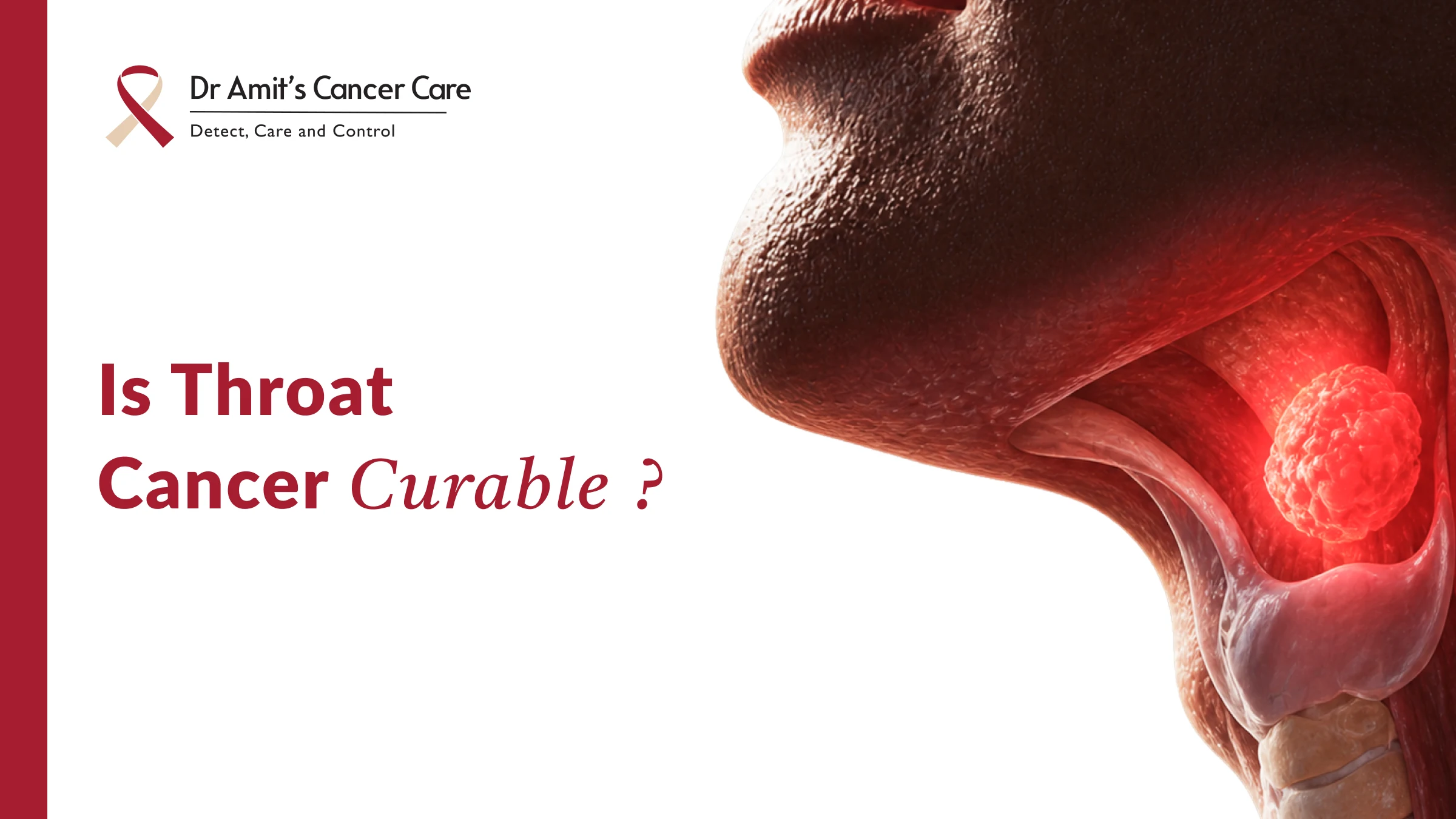 Is Throat Cancer Curable? What the Stages, Stats, and Science Actually Say