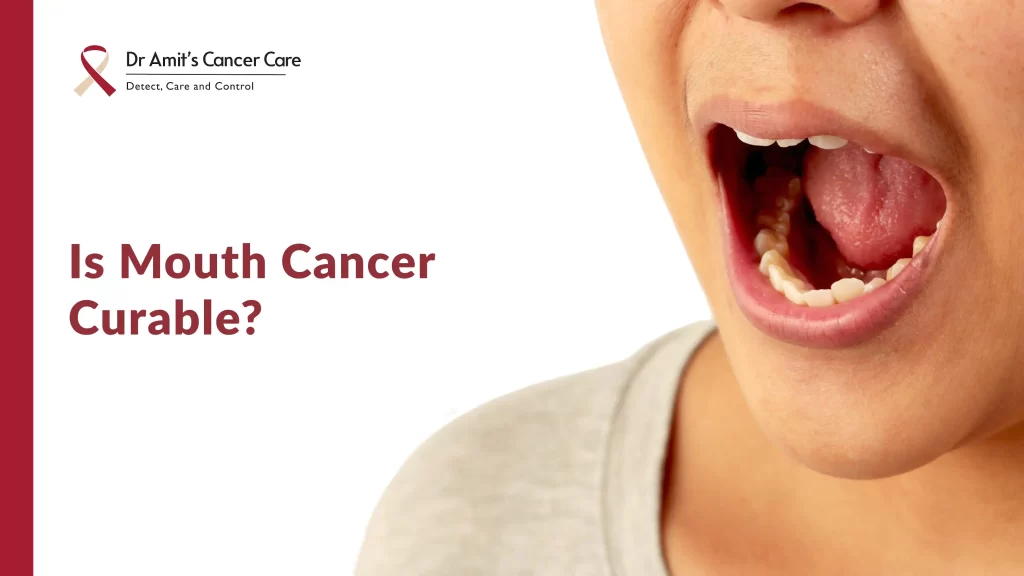 Is mouth cancer curable