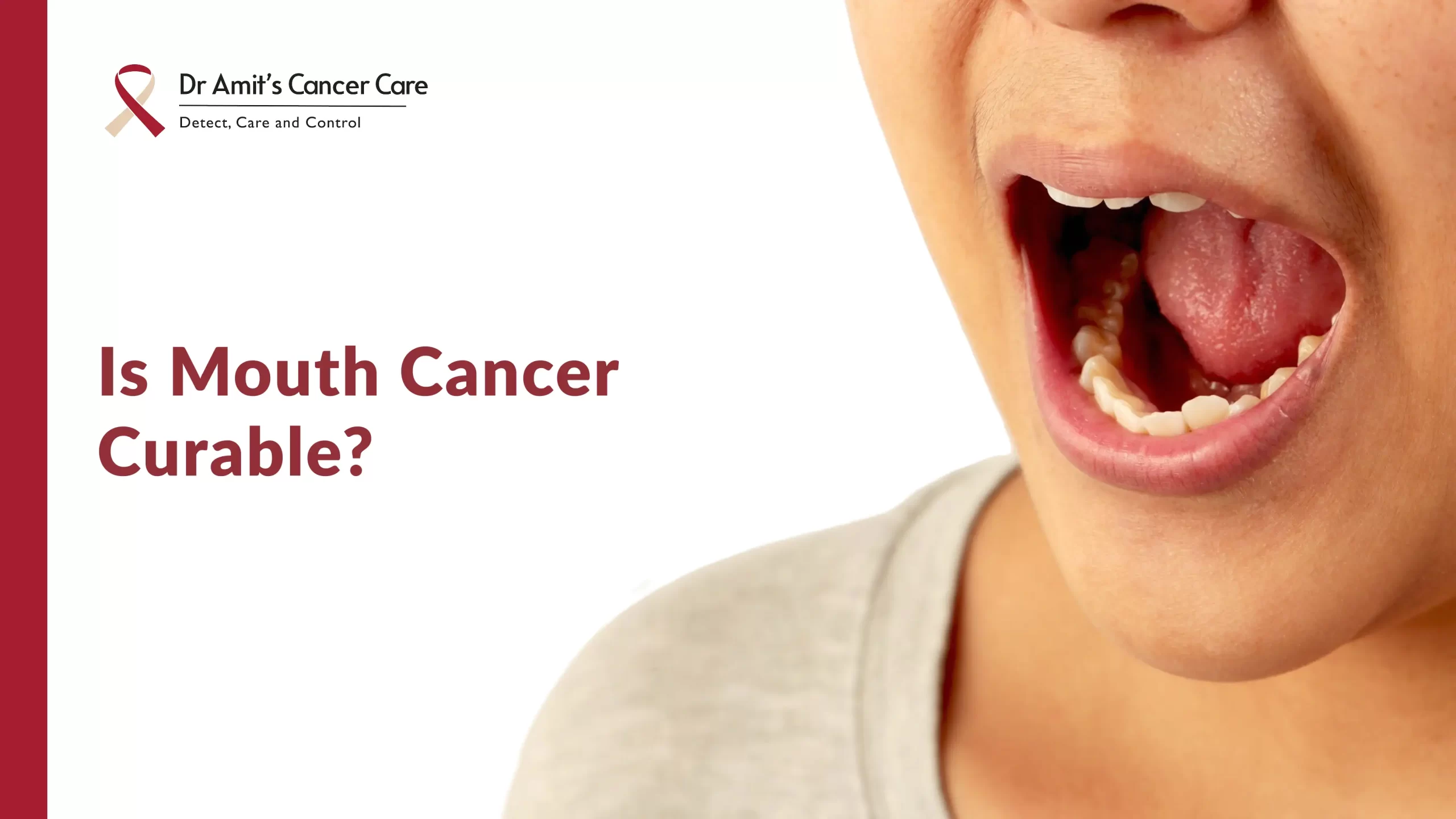 Is Mouth Cancer Curable? Understanding Treatment, Recovery, and Hope