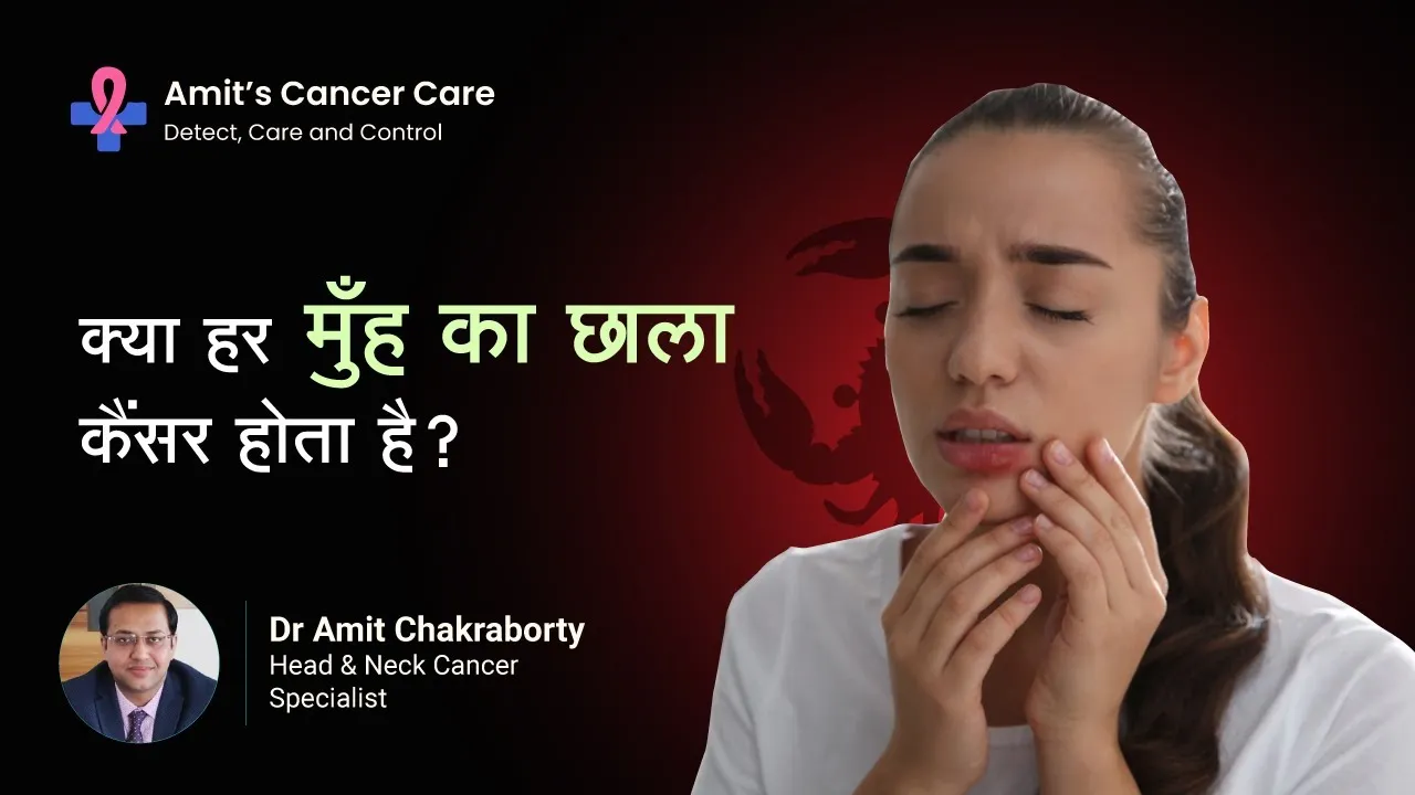 Is Every Ulcer in The Mouth is Cancerous?