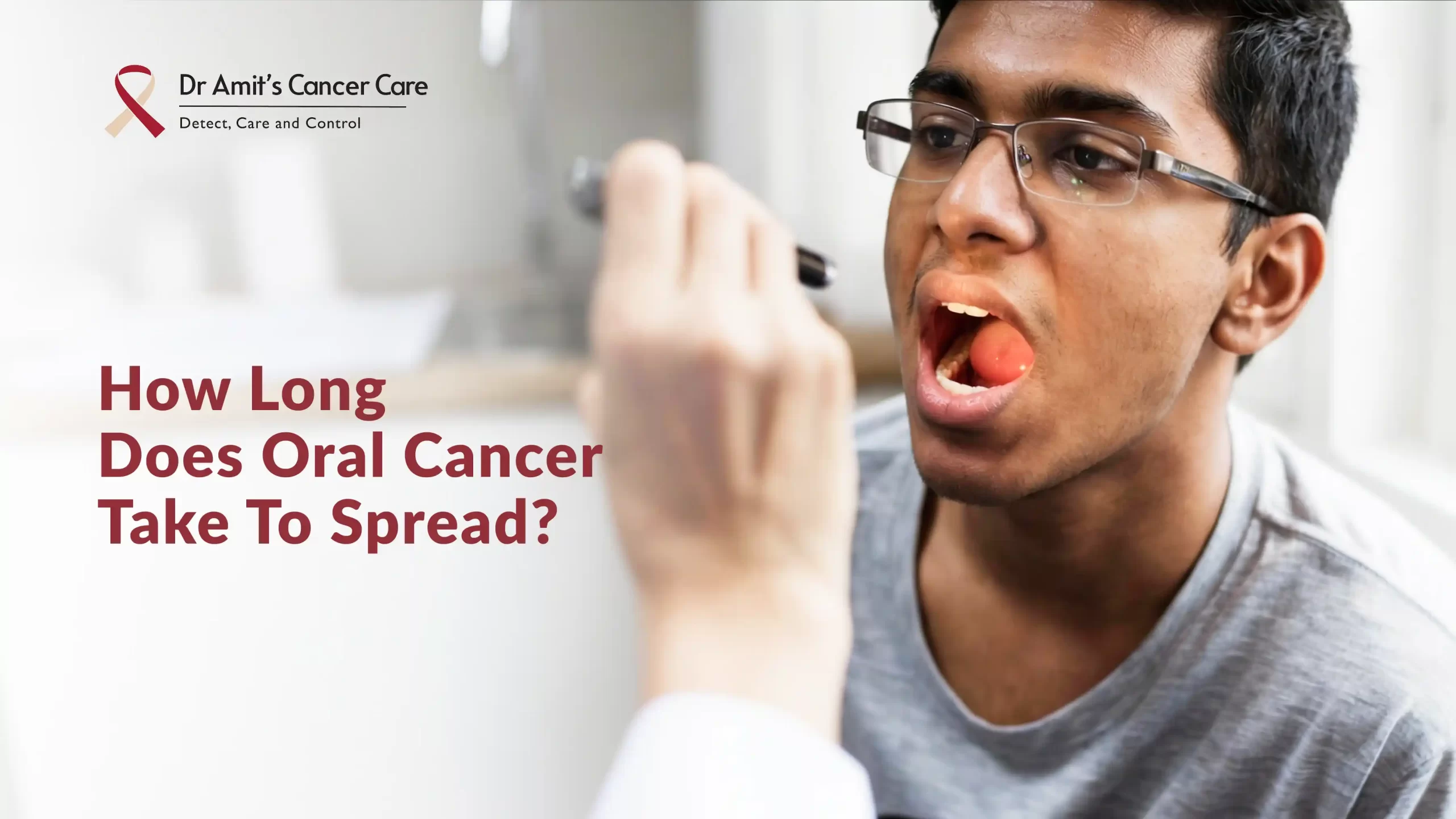 How Long Does Oral Cancer Take to Spread? 
