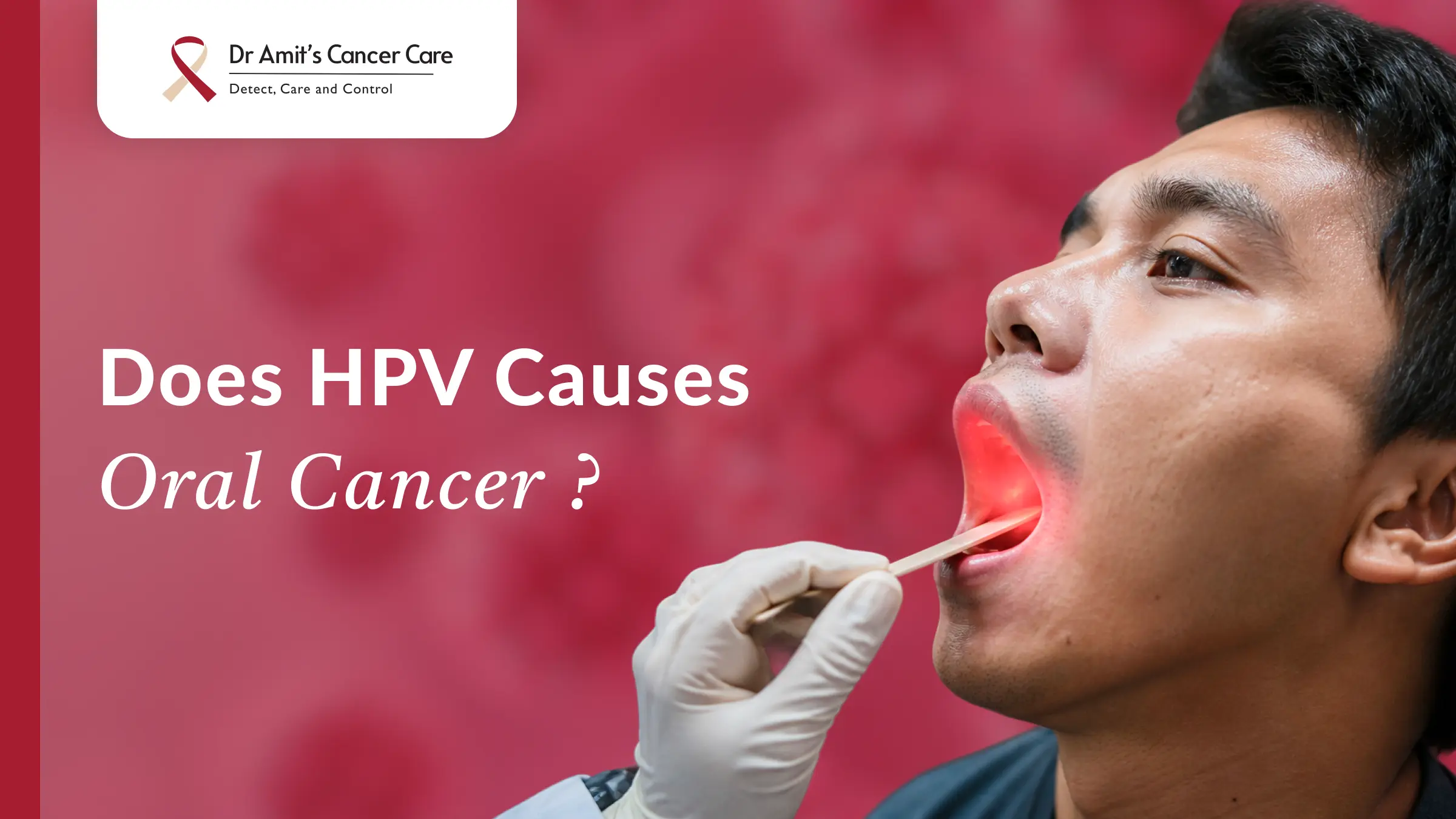 Does HPV Cause Oral Cancer? The Answer Might Surprise You