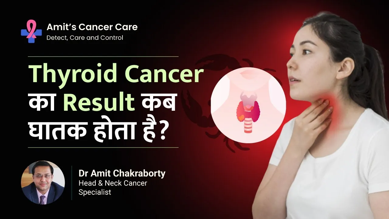 Late Stage Thyroid Cancer Survival Rate