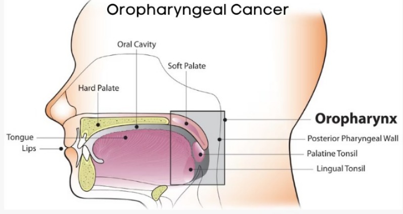 Oropharyngeal Cancer Surgical Options & Outcomes