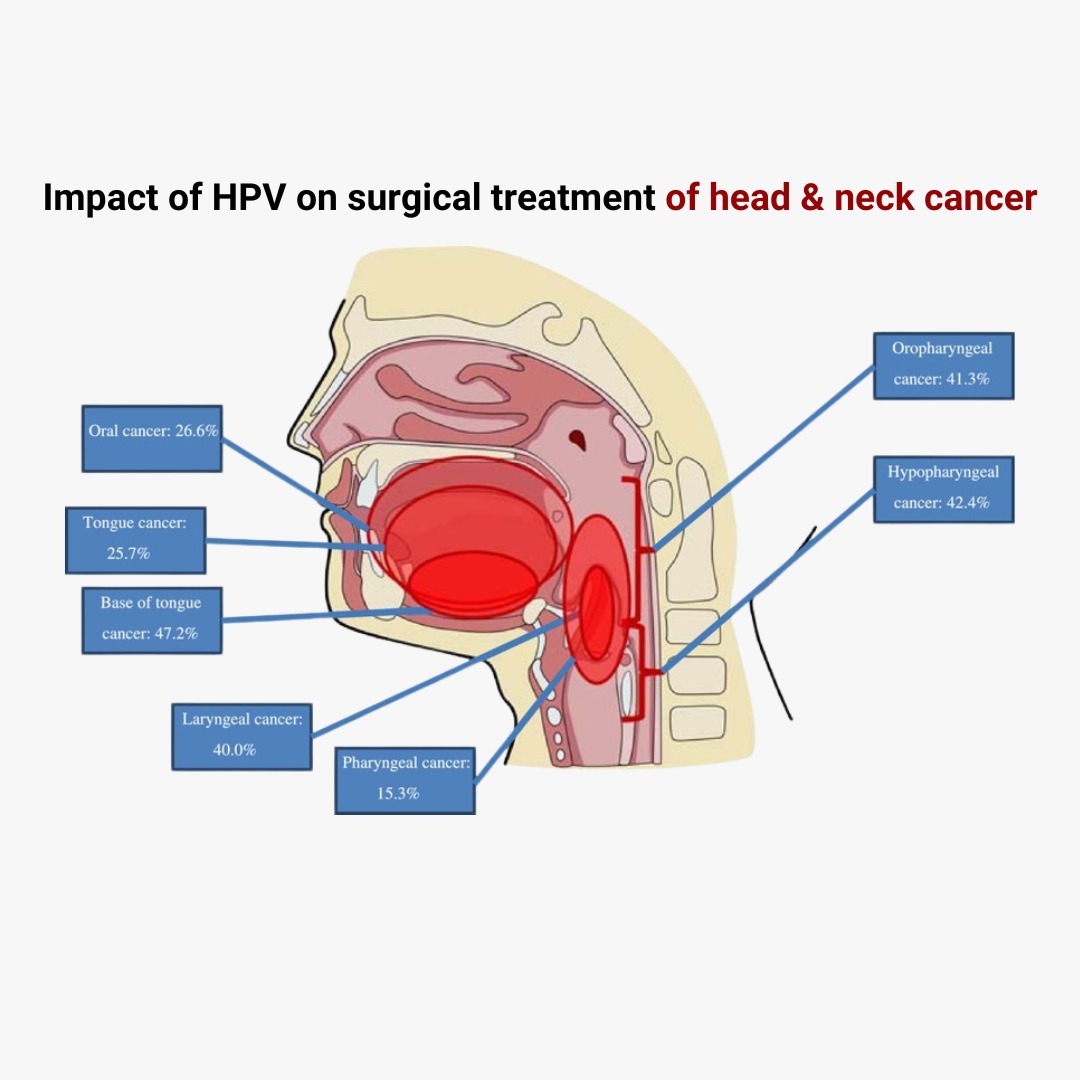 Impact of HPV on surgical treatment of head and neck cancer