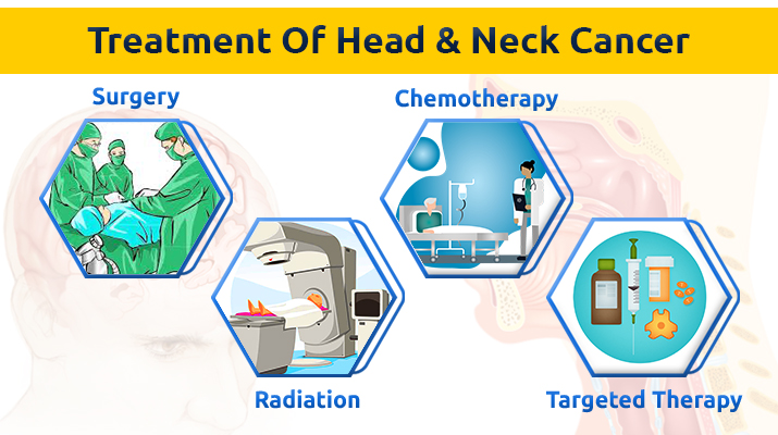 Treatment Options for Head and Neck cancer