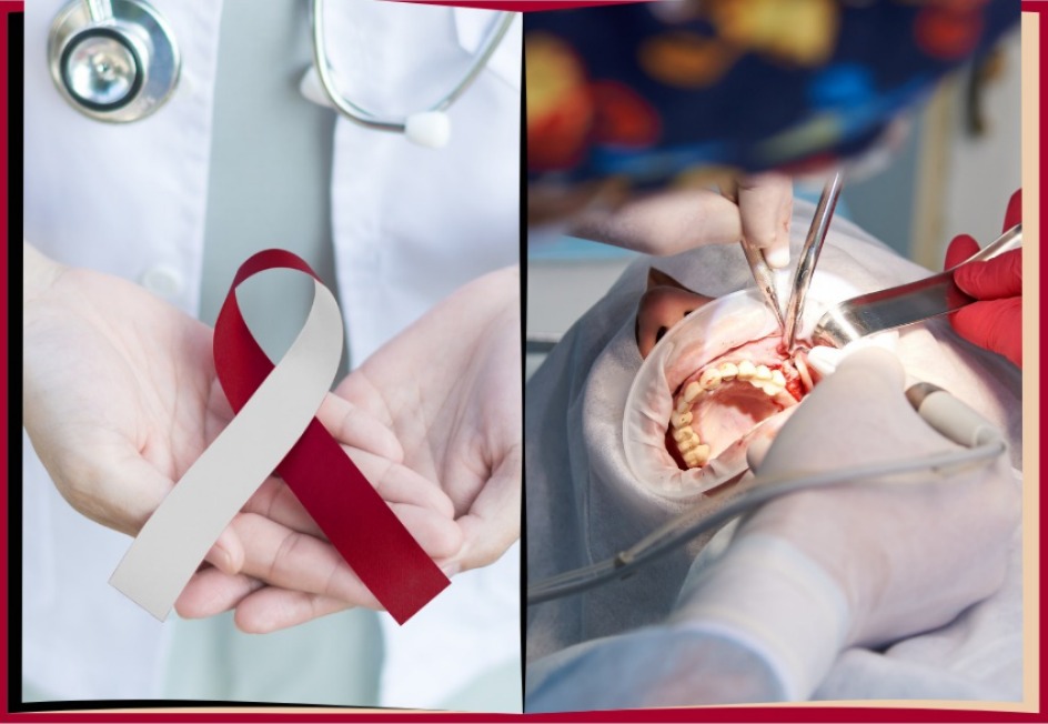 Guide to Oral Cancer Surgery and Recovery