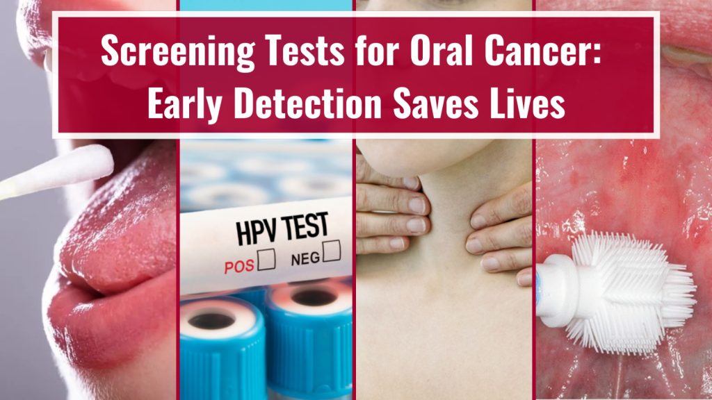 Screening Test for Oral Cancer