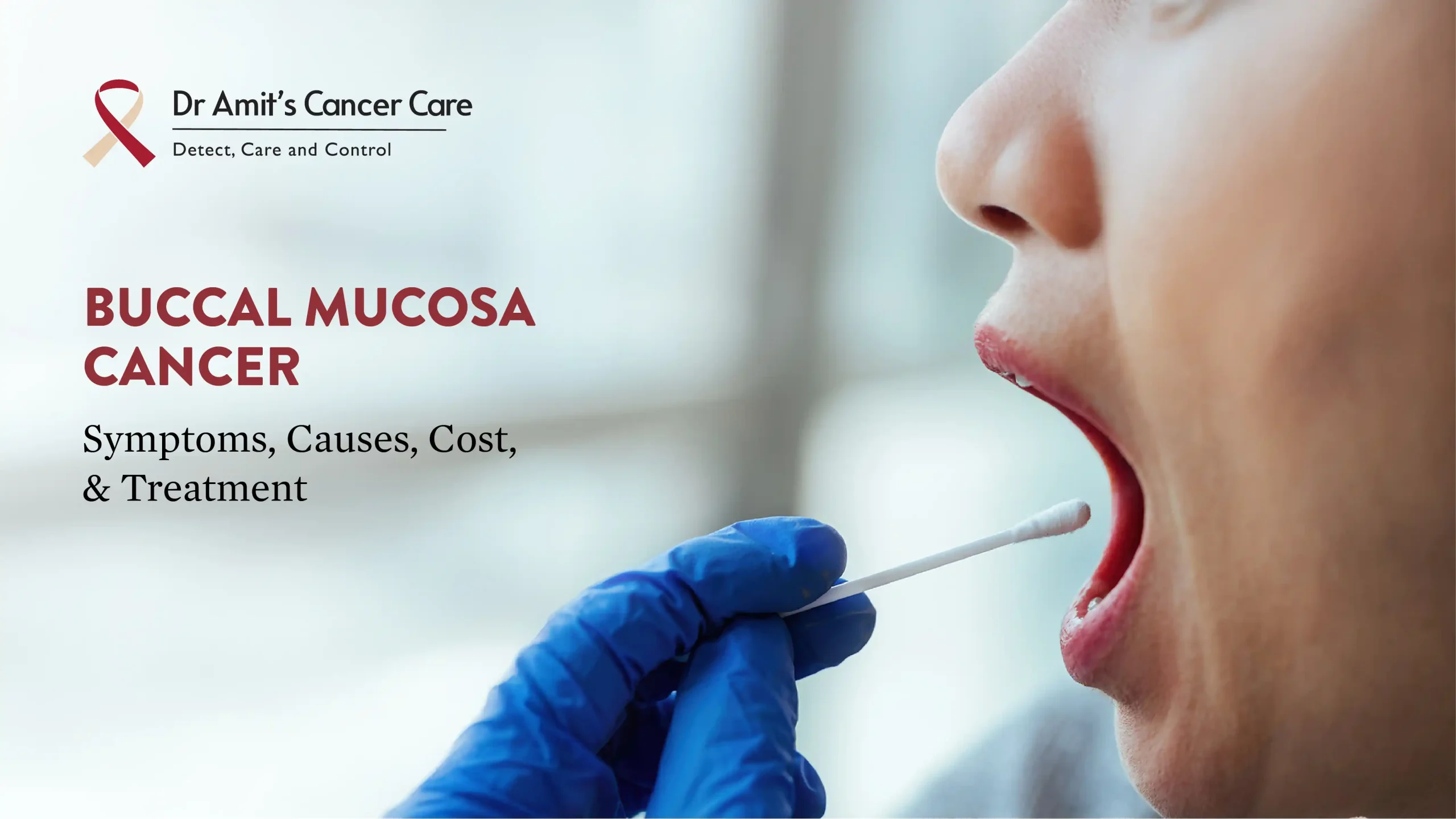 Buccal Mucosa Cancer: Symptoms, Causes, Cost & Treatment