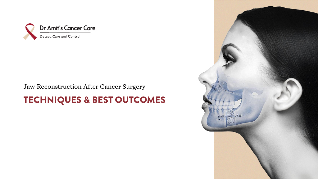 jaw reconstruction surgery after cancer