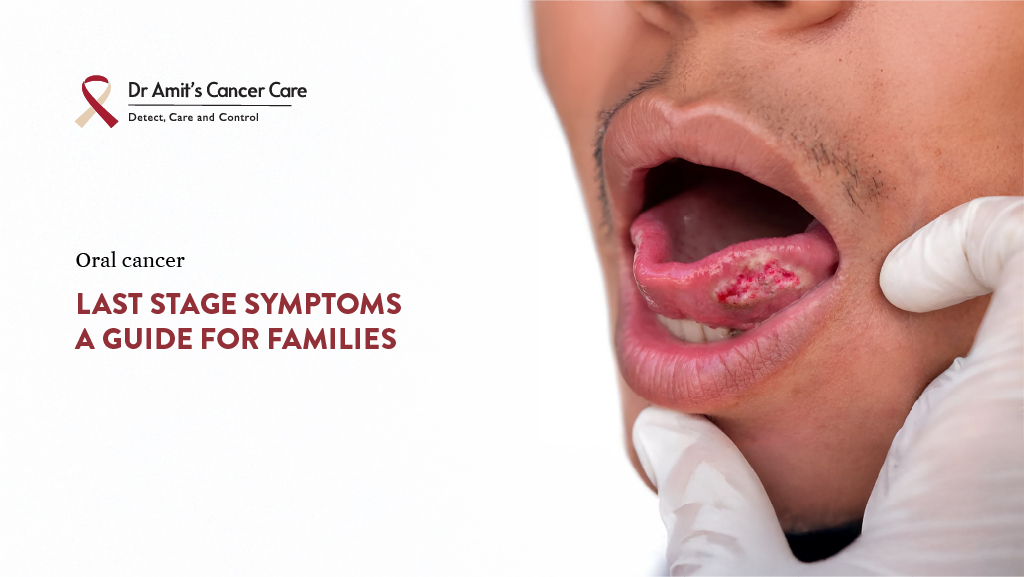 Oral Cancer Last Stage Symptoms: A Guide for Families