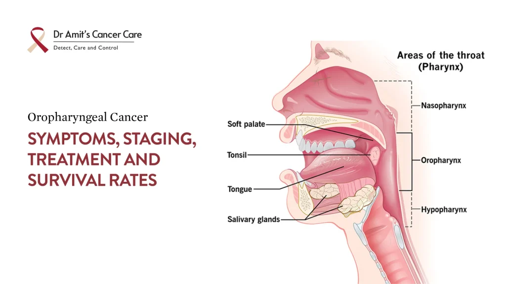 oropharyngeal cancer symptoms staging treatment survival rate
