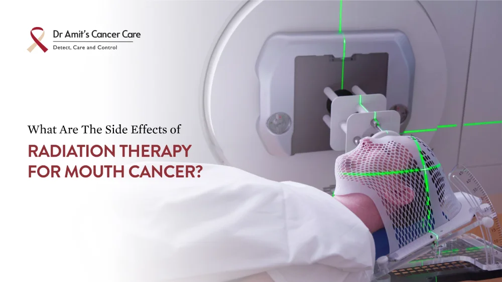 What Are the Side Effects of Radiation Therapy for Mouth Cancer?