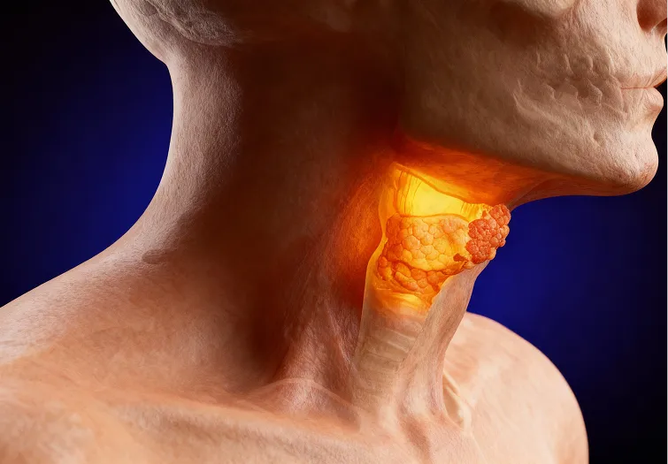 What is Laryngeal Cancer?