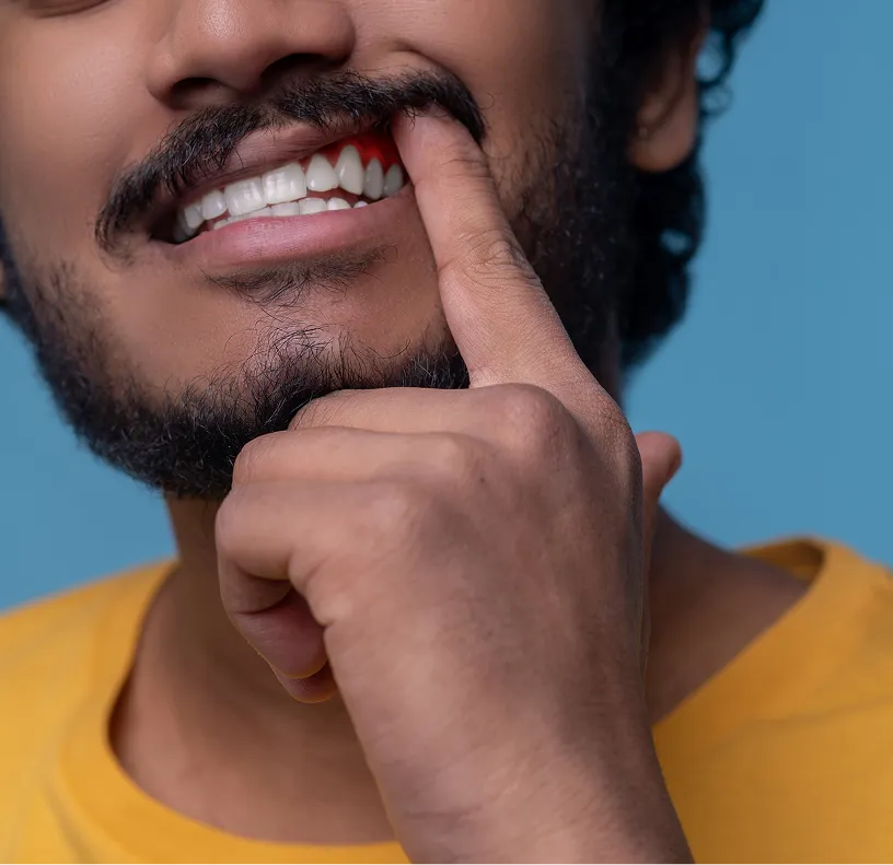 Who Is the Ideal Candidate for Oral Cancer Surgery?