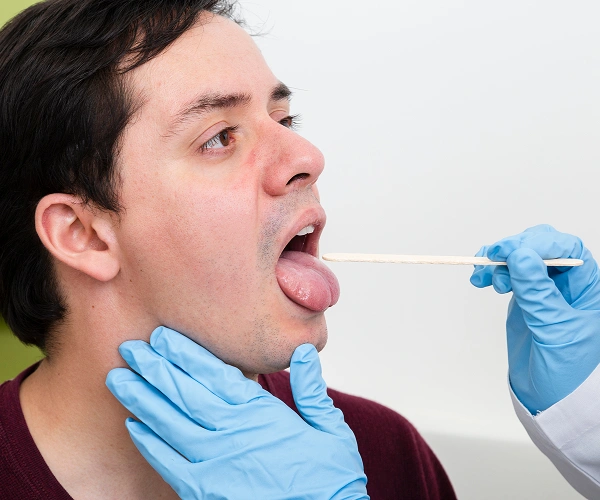 What are the Symptoms of Oral Cancer?