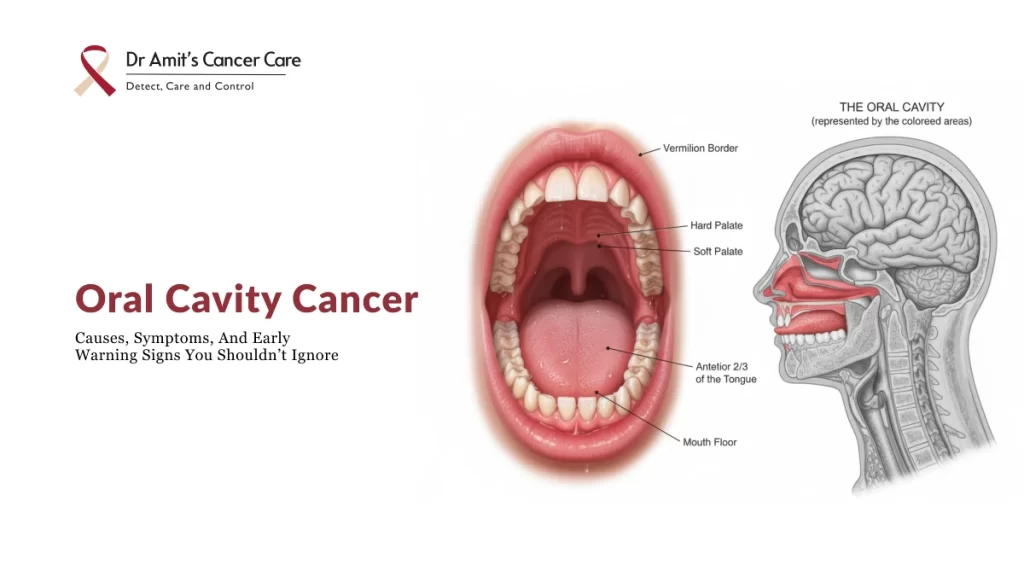 oral cavity cancer causes symptoms staging treatment