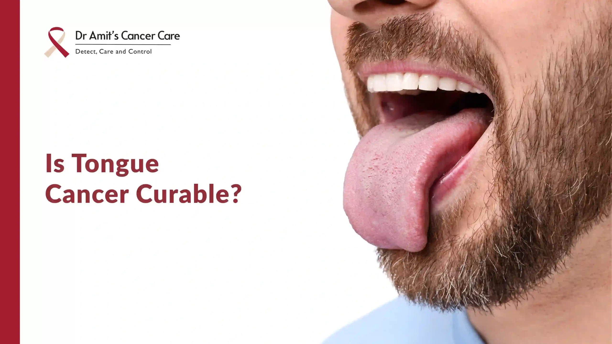 Is Tongue Cancer Curable? Understanding Treatment and Survival Across All Stages