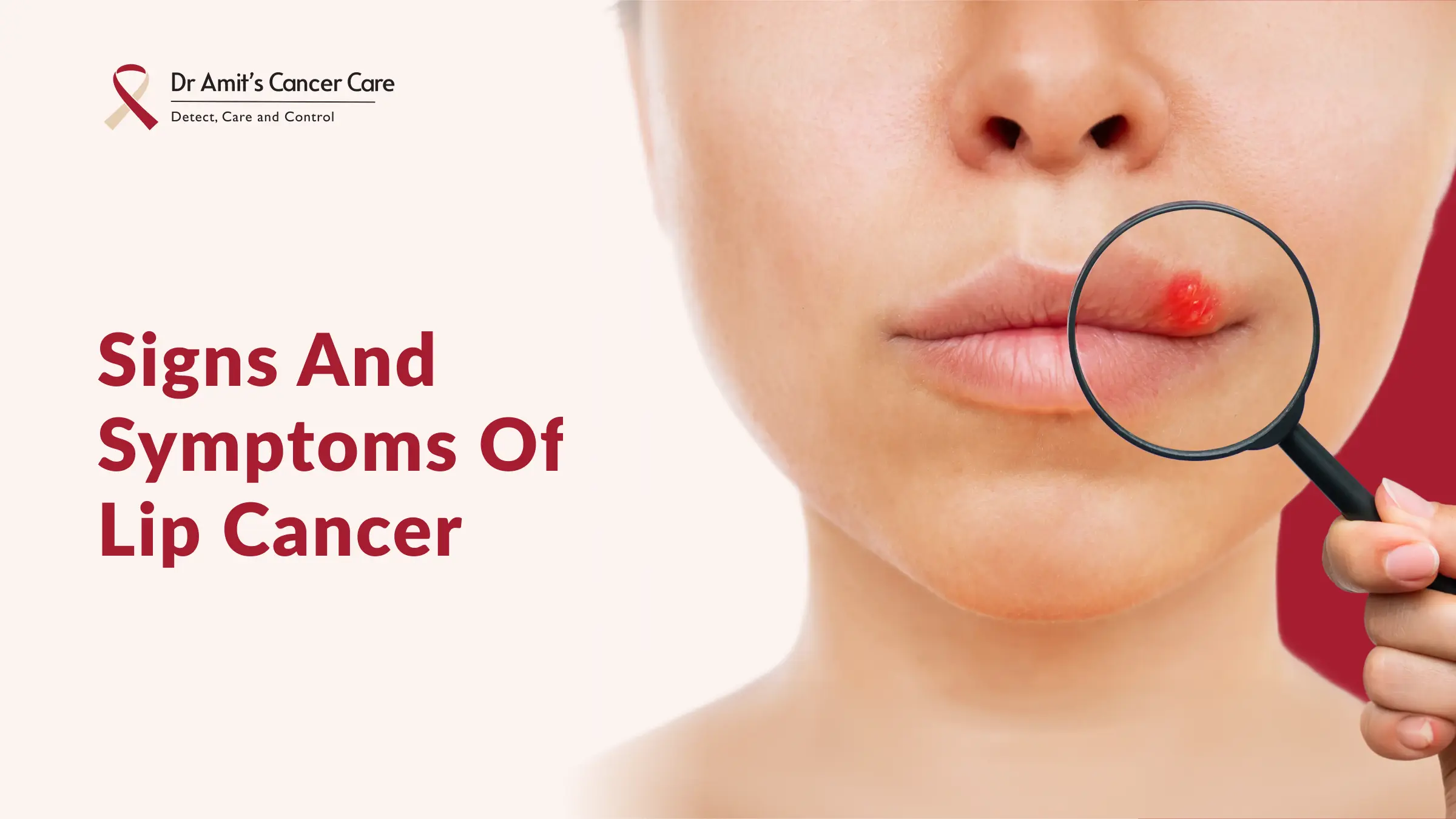 Early Signs and Symptoms of Lip Cancer You Should Never Ignore