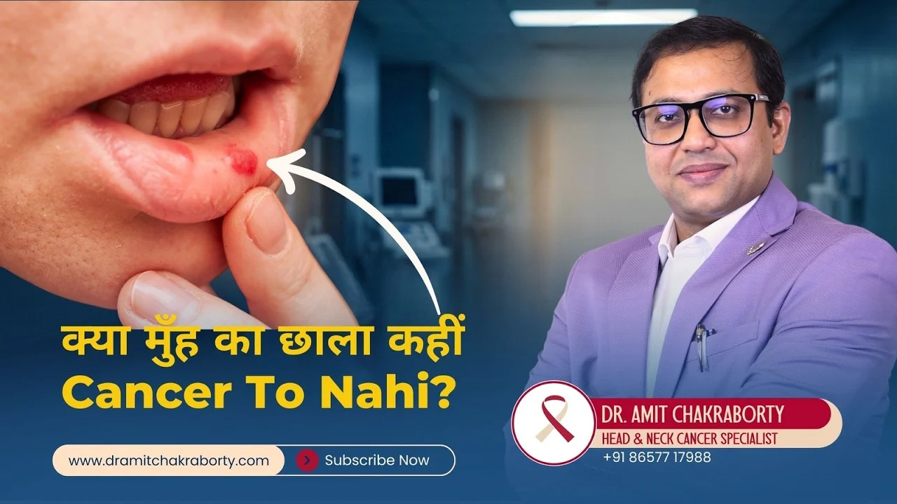 Persistent Mouth Ulcer? Could It Be Cancer – 5 Warning Signs