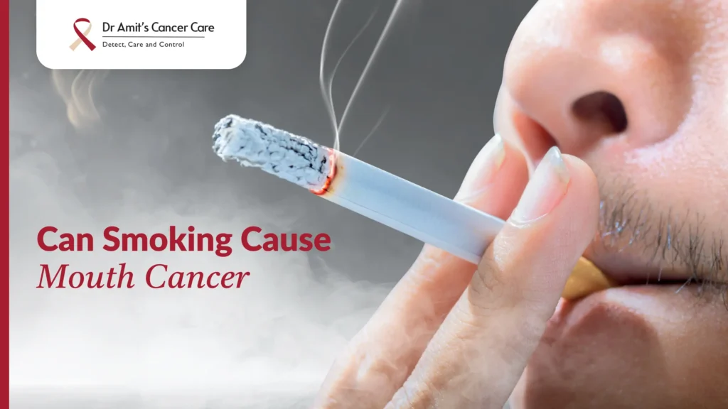 can smoking cause mouth cancer