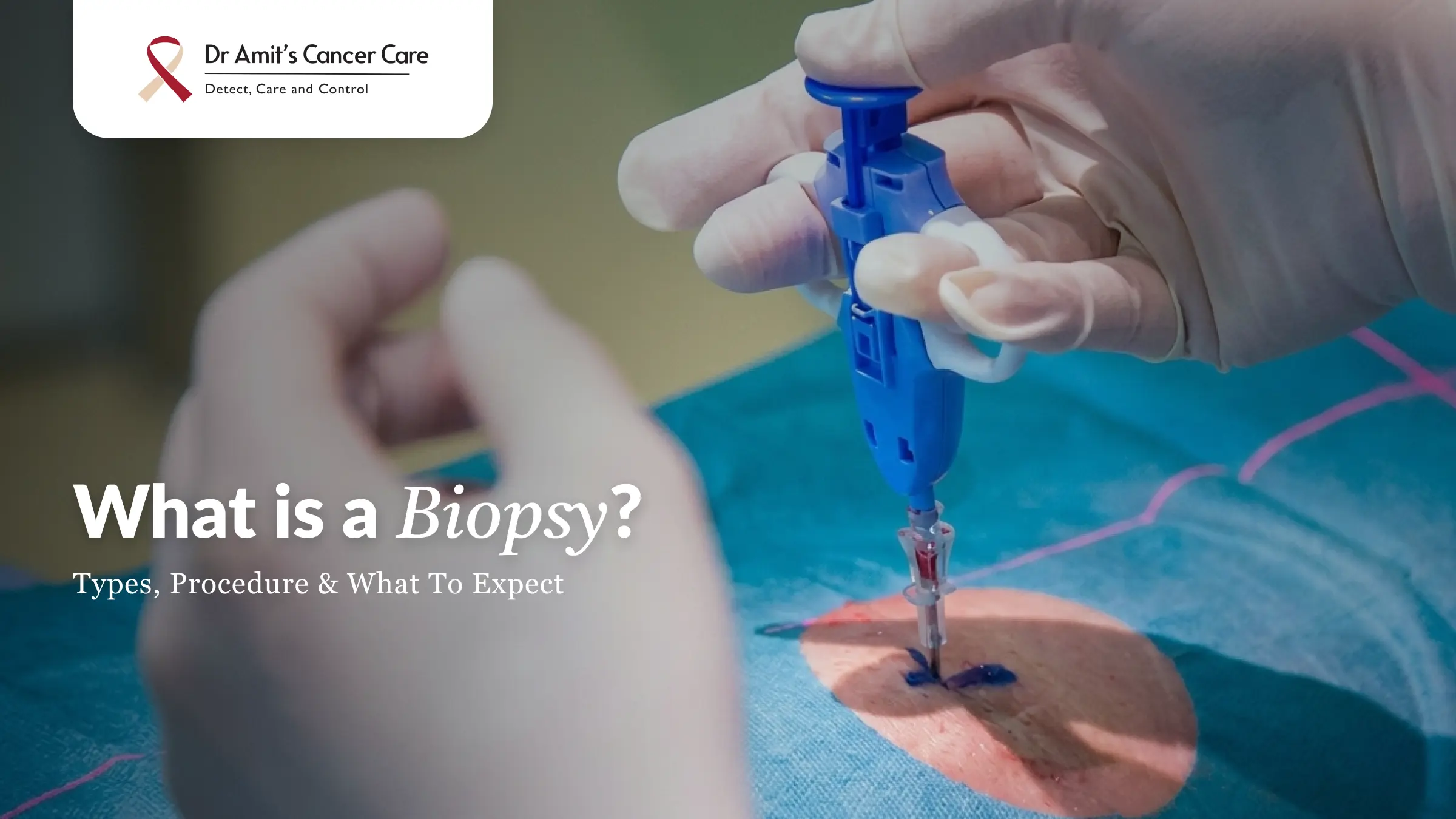 What Is a Biopsy? Types, Procedure & What to Expect
