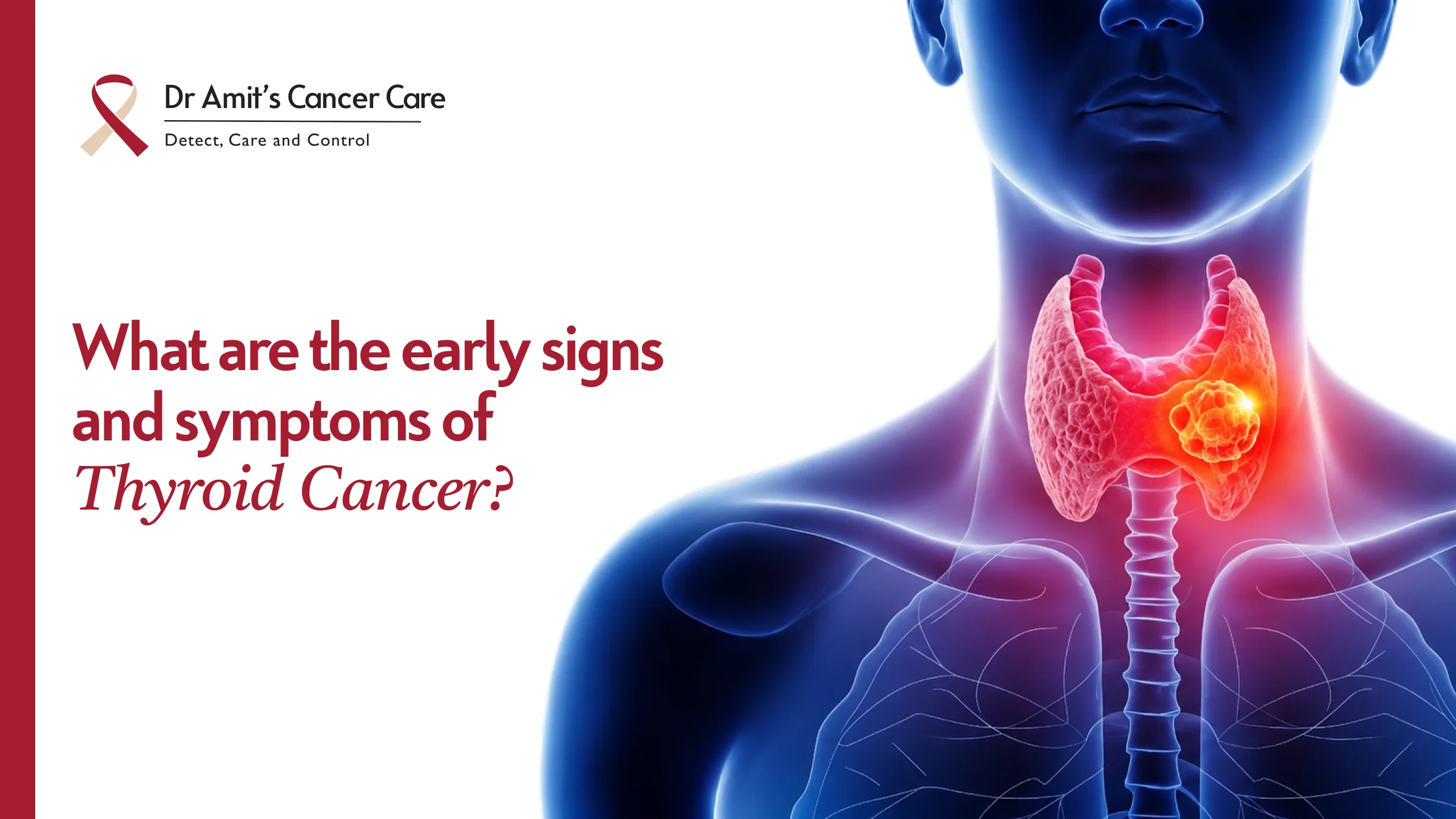 What Are the Early Signs of Thyroid Cancer? What Your Neck Might Be Telling You