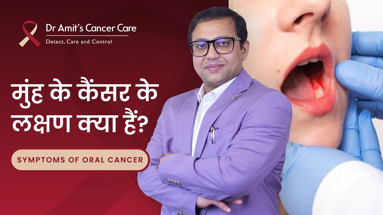 मुंह के कैंसर के लक्षण क्या हैं? | Symptoms of Oral Cancer? | Dr Amit Chakraborty