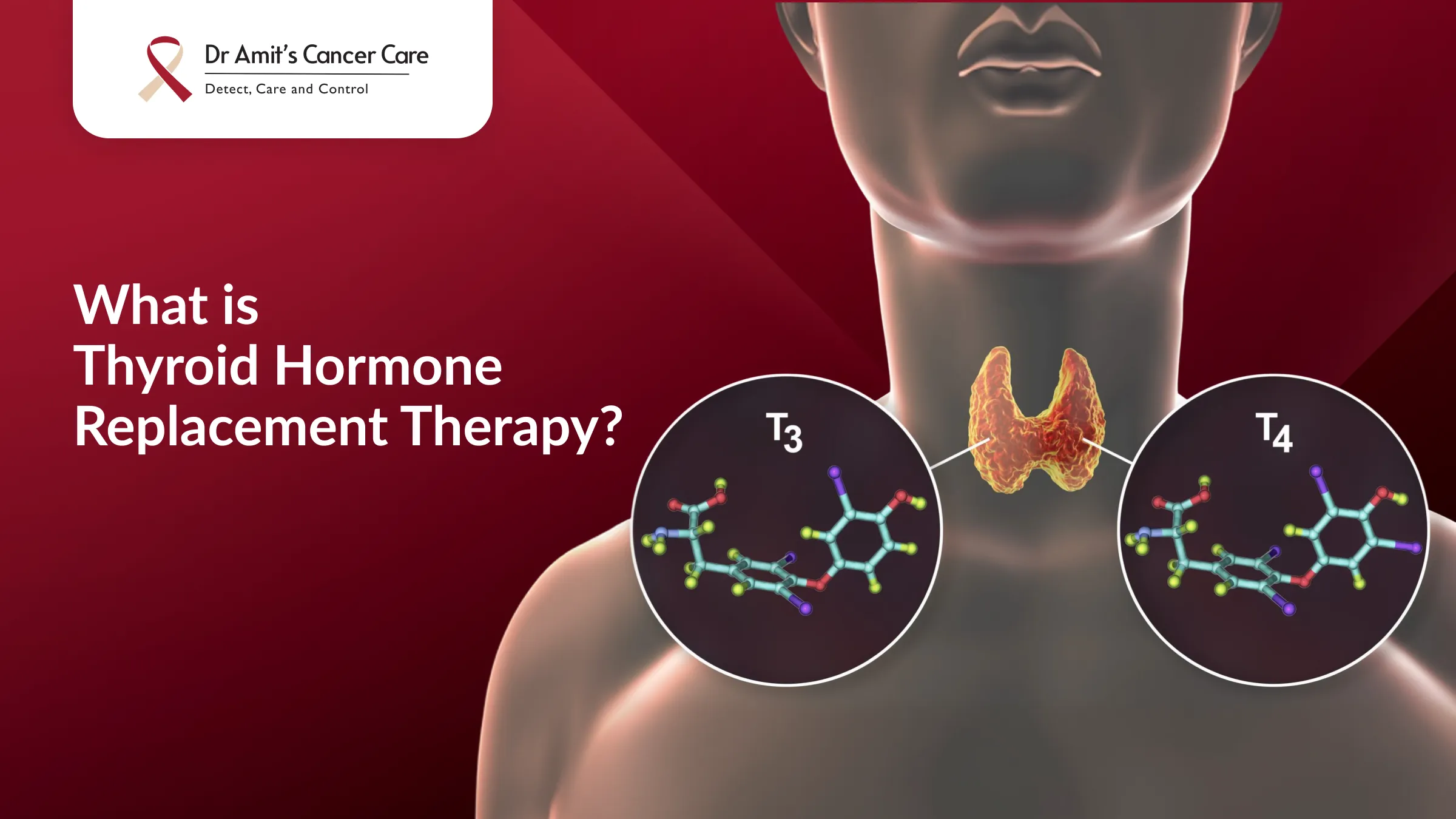 What Is Thyroid Hormone Replacement Therapy? A Complete, Simple Guide