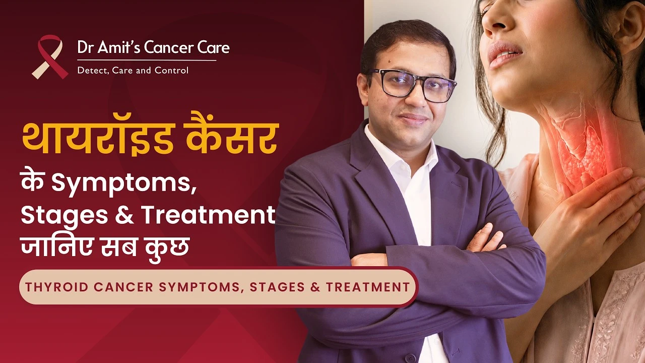 Thyroid Cancer के लक्षण, स्टेज और इलाज जानिए सब कुछ | Thyroid Cancer in Hindi | Neck Cancer