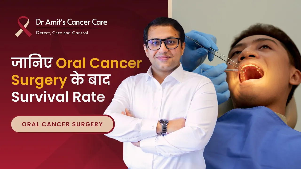 Life Expectancy After Oral Cancer | Oral Cancer में मरीज़ की ज़िंदगी कितनी होती है? | Dr Amit