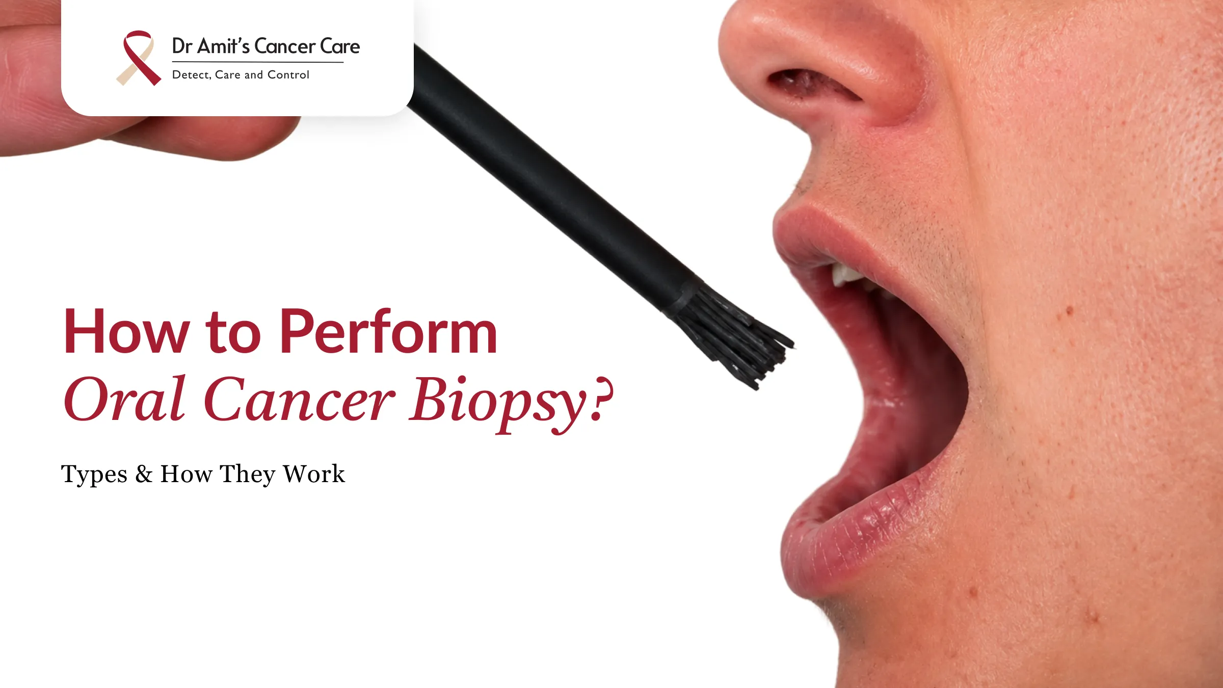 How to Perform an Oral Cancer Biopsy?
