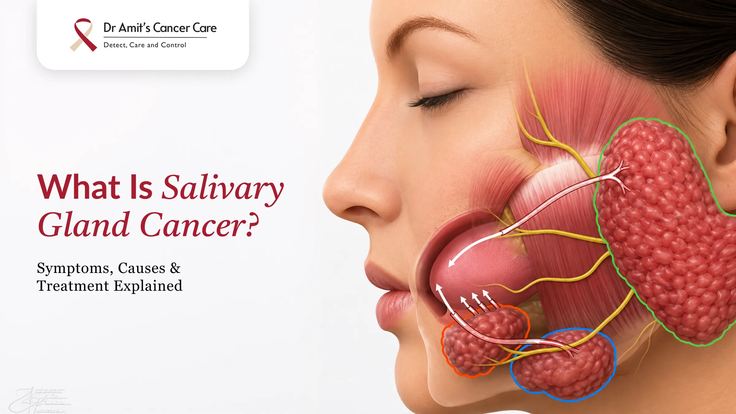 What Is Salivary Gland Cancer? Symptoms, Causes & Treatment Explained